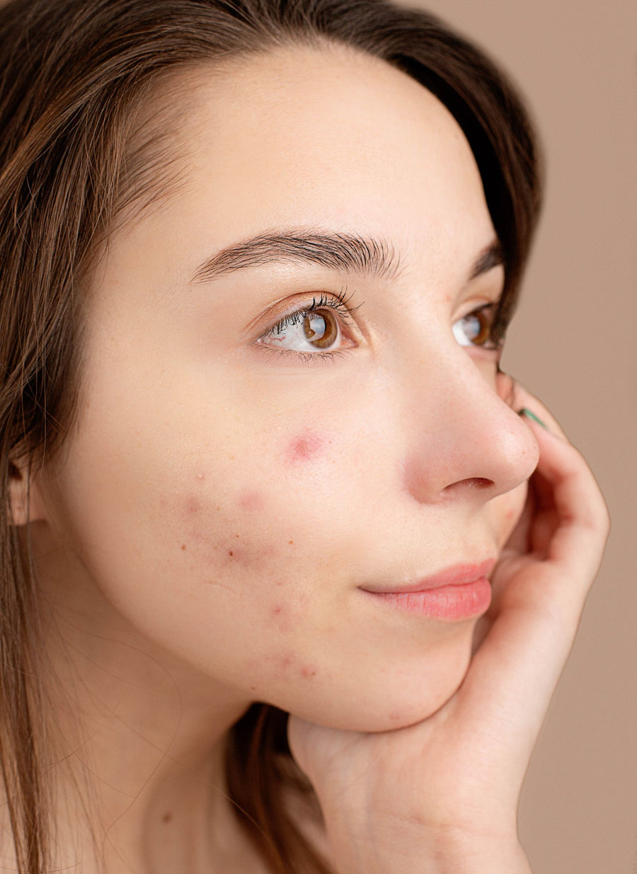 Purge ou irritation : comment faire la différence après un nouveau soin