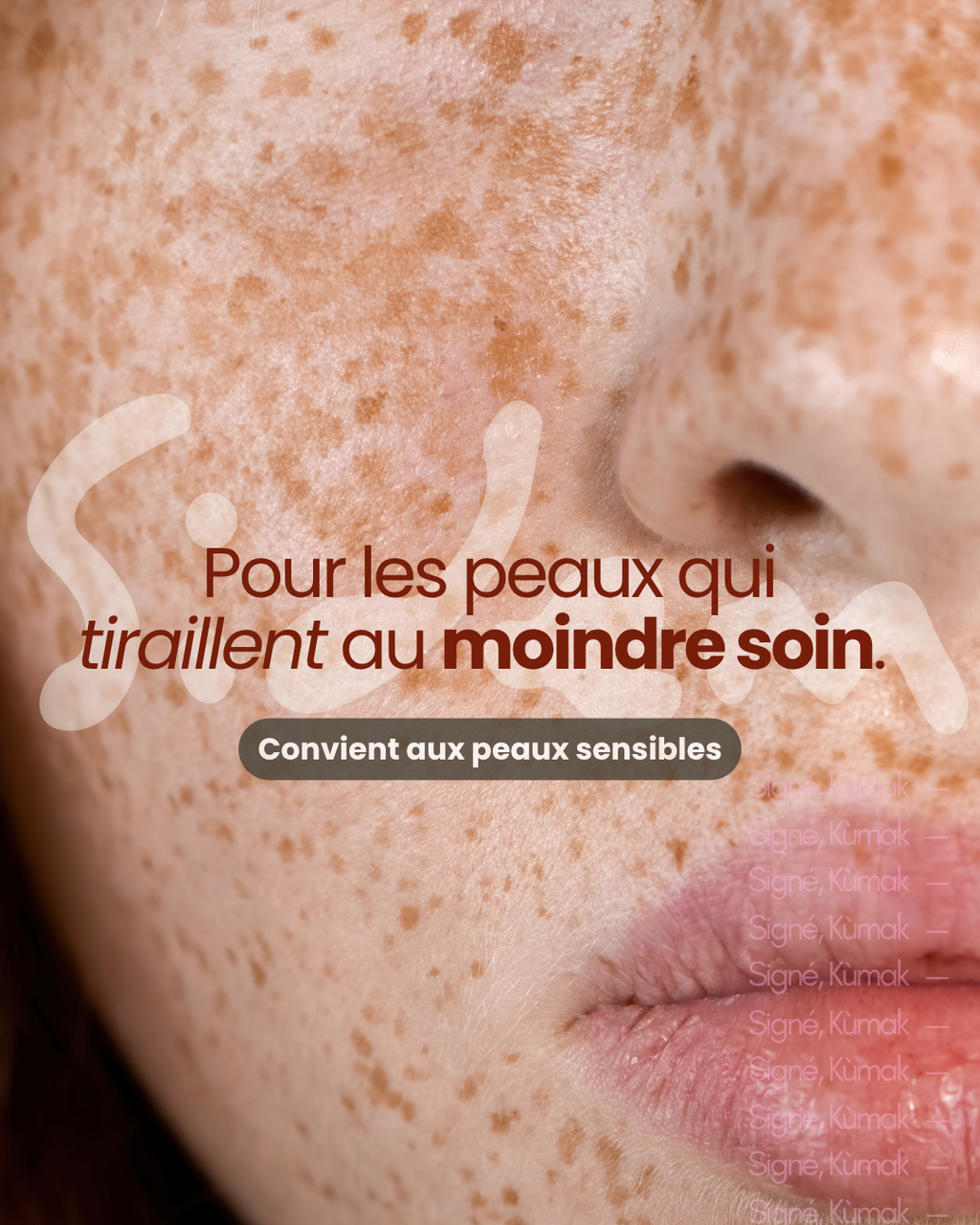Gros plan d'une peau sensible, visuel SIDEM poudre de jujubier