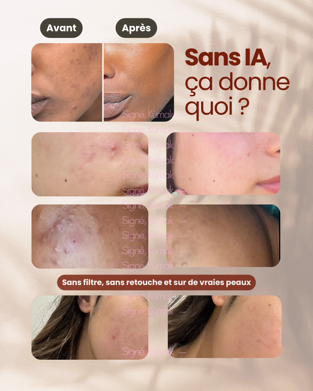 Photos avant et après de peaux de clientes SIDEM, sans filtre ni retouche
