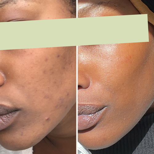 SIDEM, Édition limitée “0 Gâchis” — Poudre de Jujubier & Curcuma