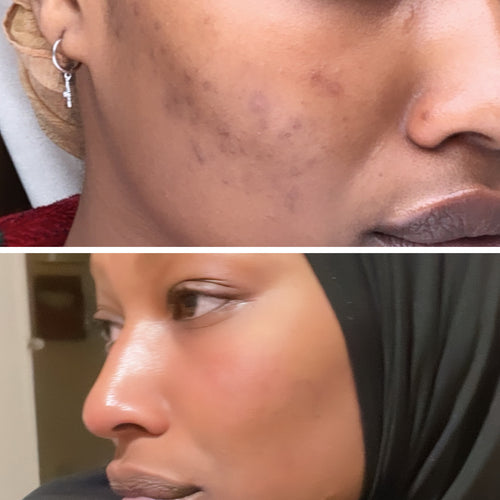 DUO SIDEM, Poudre moussante — Jujubier & Curcuma